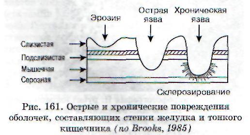 Питание при эрозии желудка