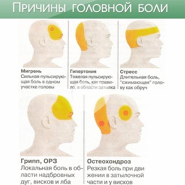 Сильные затылочные боли. Схема локализации головной боли. Причины головной боли.