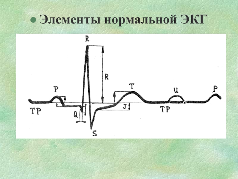 Экг рисунок с обозначениями