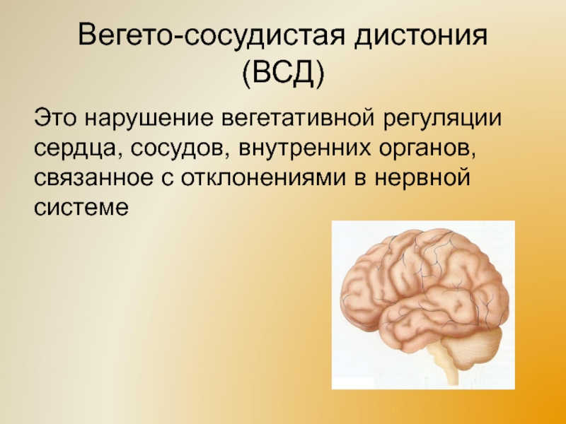 Вегето сосудистая дистония что это. ВСД что это. ВСД картинки для презентации. Вегето-сосудистый синдром характеризуется. Дистония сосудов.