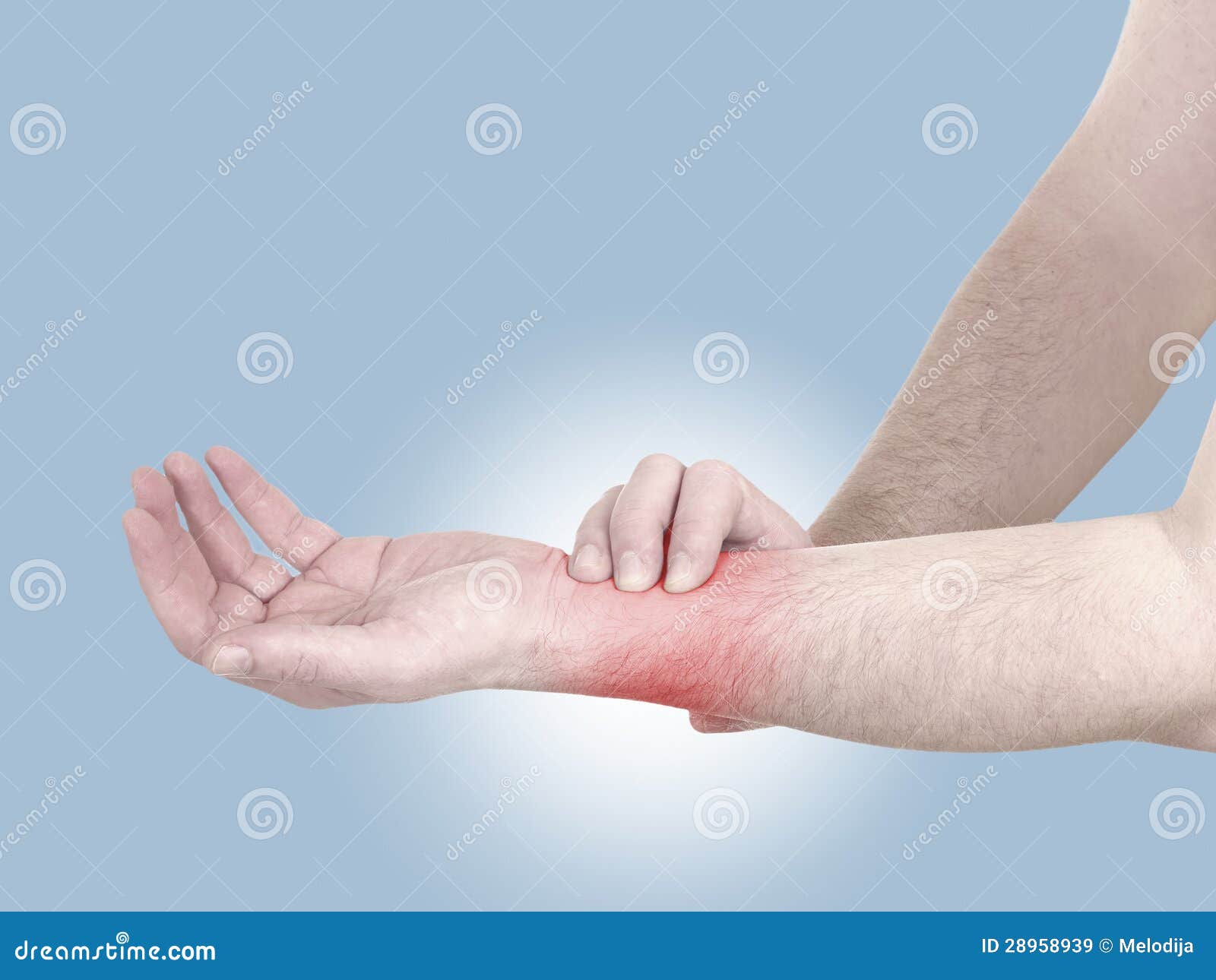 Болит рука запястье чем лечить. Боль в руке. Боль в запястье левой руки. Болит лучезапястный сустав левой руки.