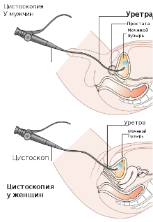 Строение пениса и клитора в продольном разрезе
