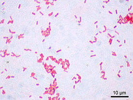 Escherichia coli Gram.jpg
