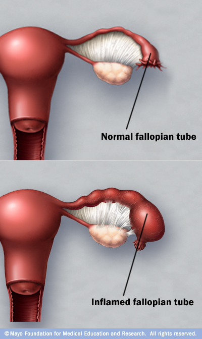 Фаллопиевы трубы фото