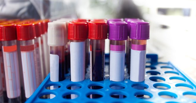 ГГТ в биохимическом анализе крови – что делать, если показатель повышен?