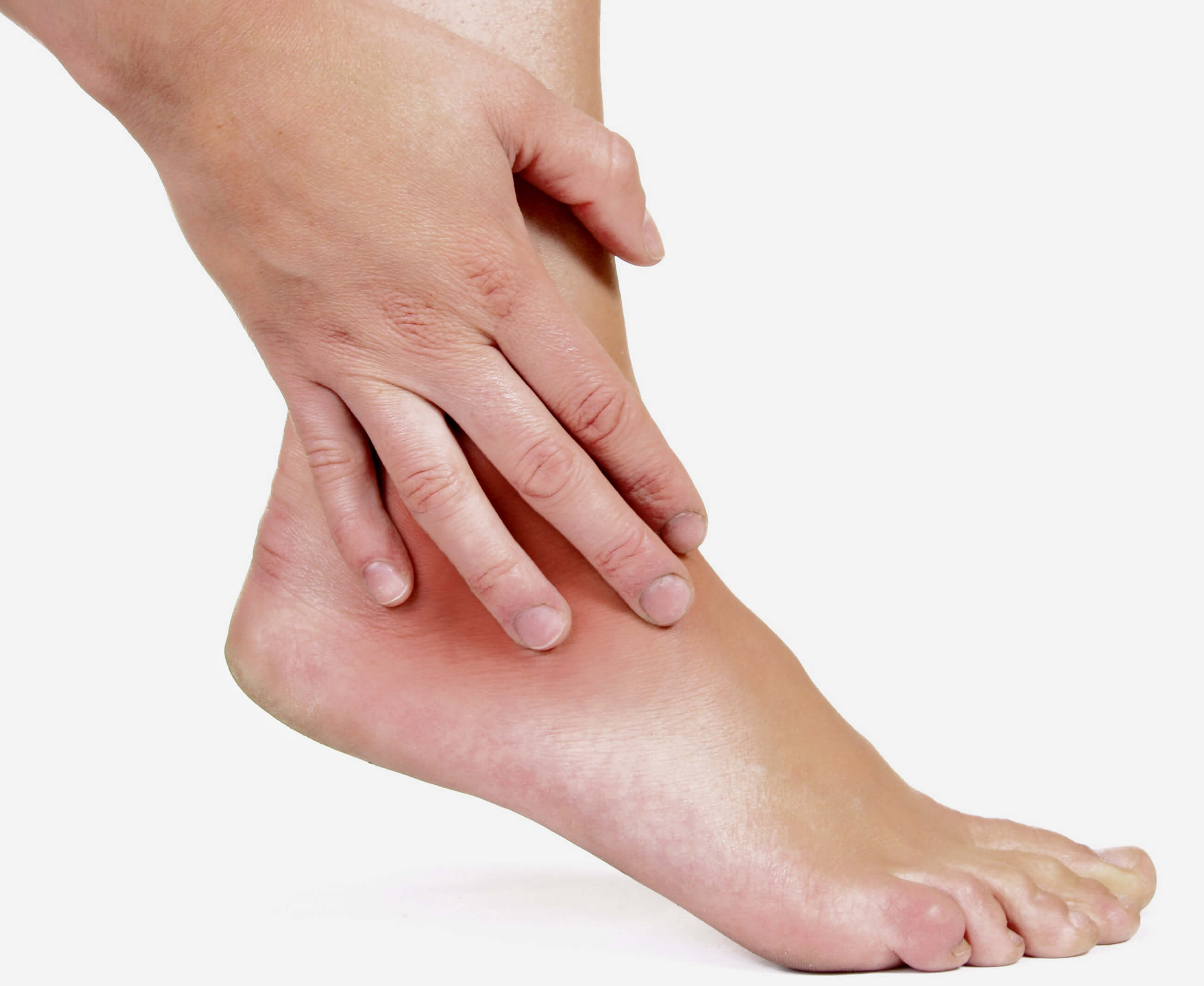 Болит большой палец ноги при ходьбе. Ревматоидный артрит голеностопного. Стопы ног.