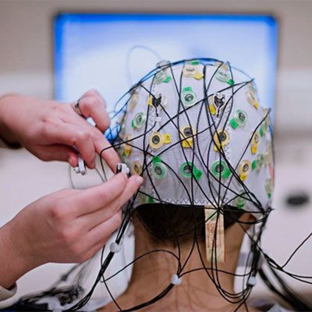 Ээг пермь. Электроэнцефалография (ЭЭГ). EEG elektroentsefalografiya. Нейротех ЭЭГ. Электроэнцефалографическое исследование (ЭЭГ.