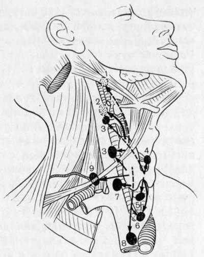 Миндалины и лимфоузлы на шее схема