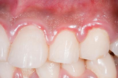история болезни зубы 