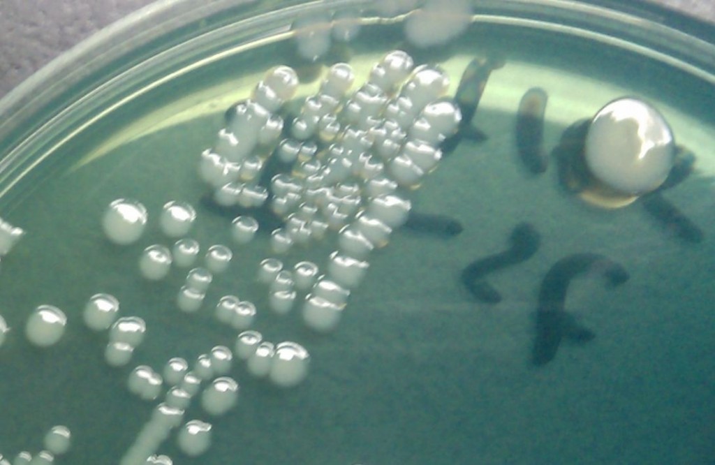 Размножение бактерий в питательной среде