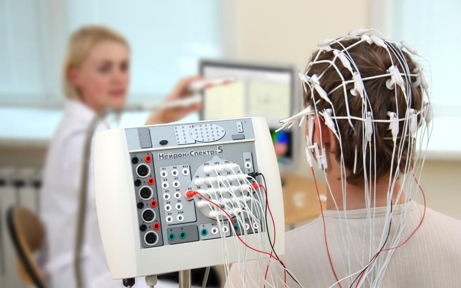 Электроэнцефалография головного мозга