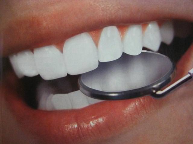 Врач сможет определить причину потемнения эмали и очистить зубы