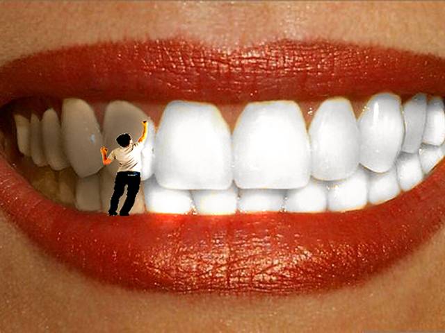 Изменение цвета зубов может быть вызвано различными причинами